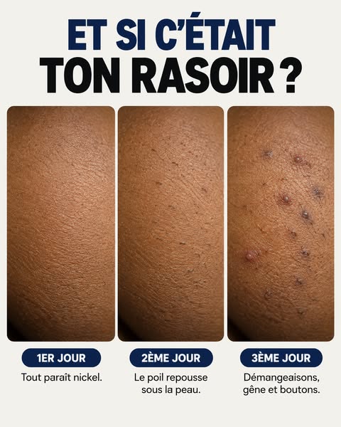 Pourquoi ça revient toujours ?