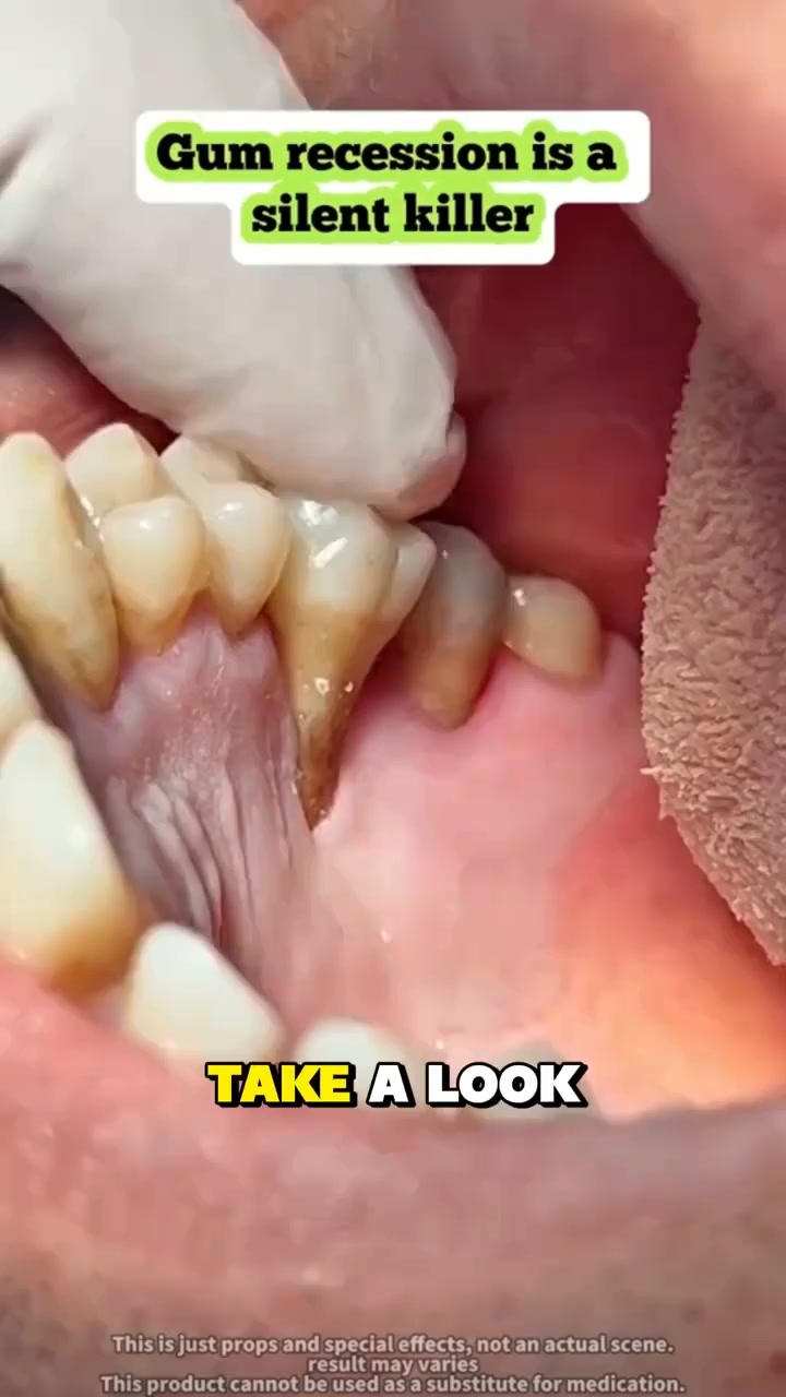 Dentists Are FURIOUS This Video Leaked! (Do This Tonight To Regrow Your Gums)