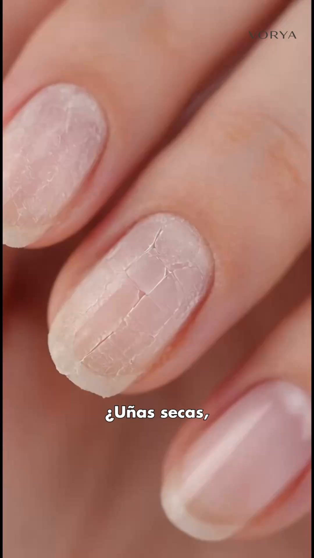 Vuelve a cuidar tus uñas como antes.