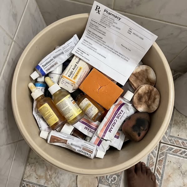 Read This If You Have Hyperpigmentation And Nothing's Worked
