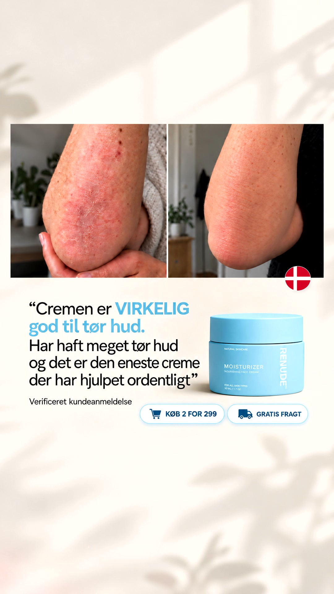 Naturlig Hudpleje Til Tør Hud | ELSKET AF 10.000+ DANSKERE