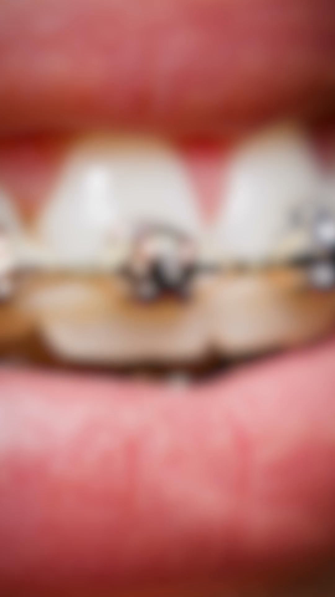 Book Your Specialist Invisalign Consultation Today