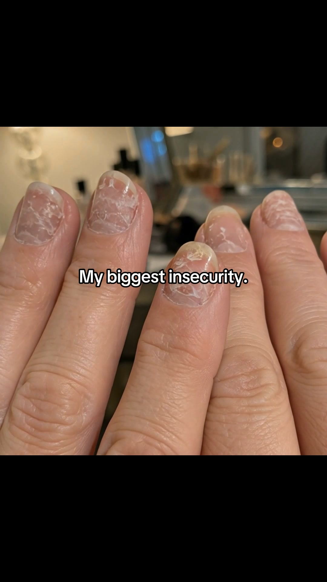 Why Nails Break After 50