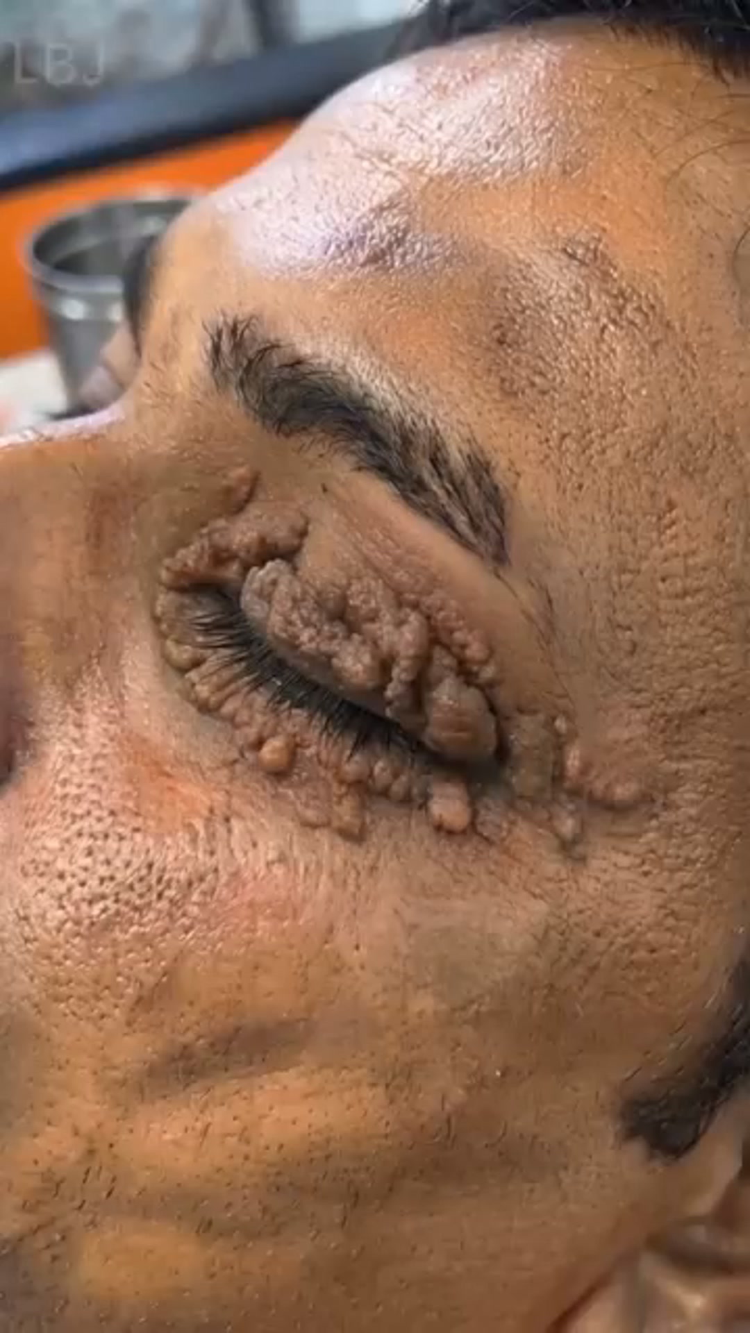 Target Stubborn-Looking Skin Spots