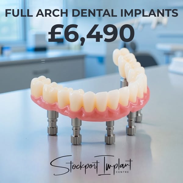 Full Arch Dental Implants From £6,490
