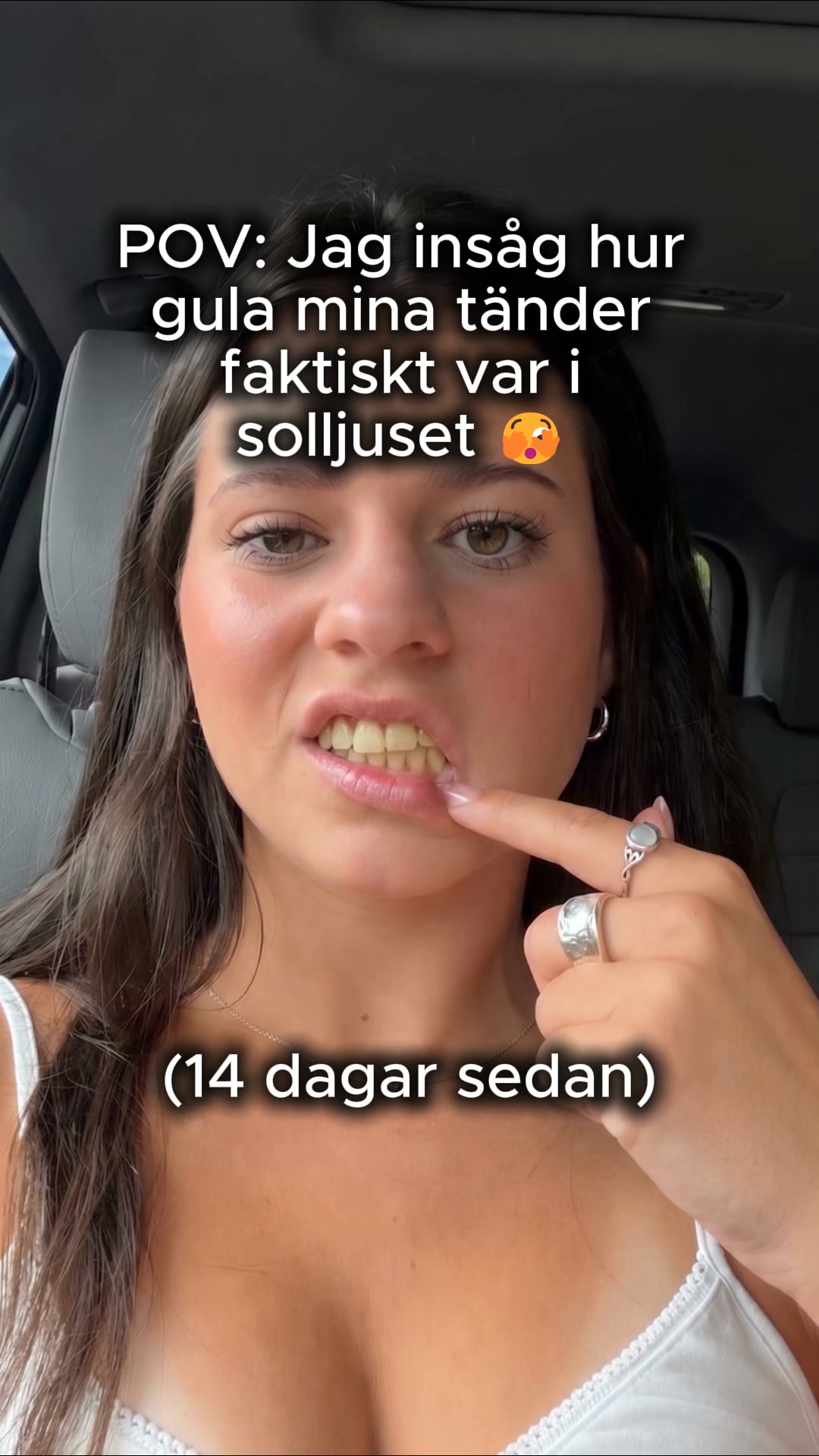 Gula toner? Bli av med dem på 30 sekunder