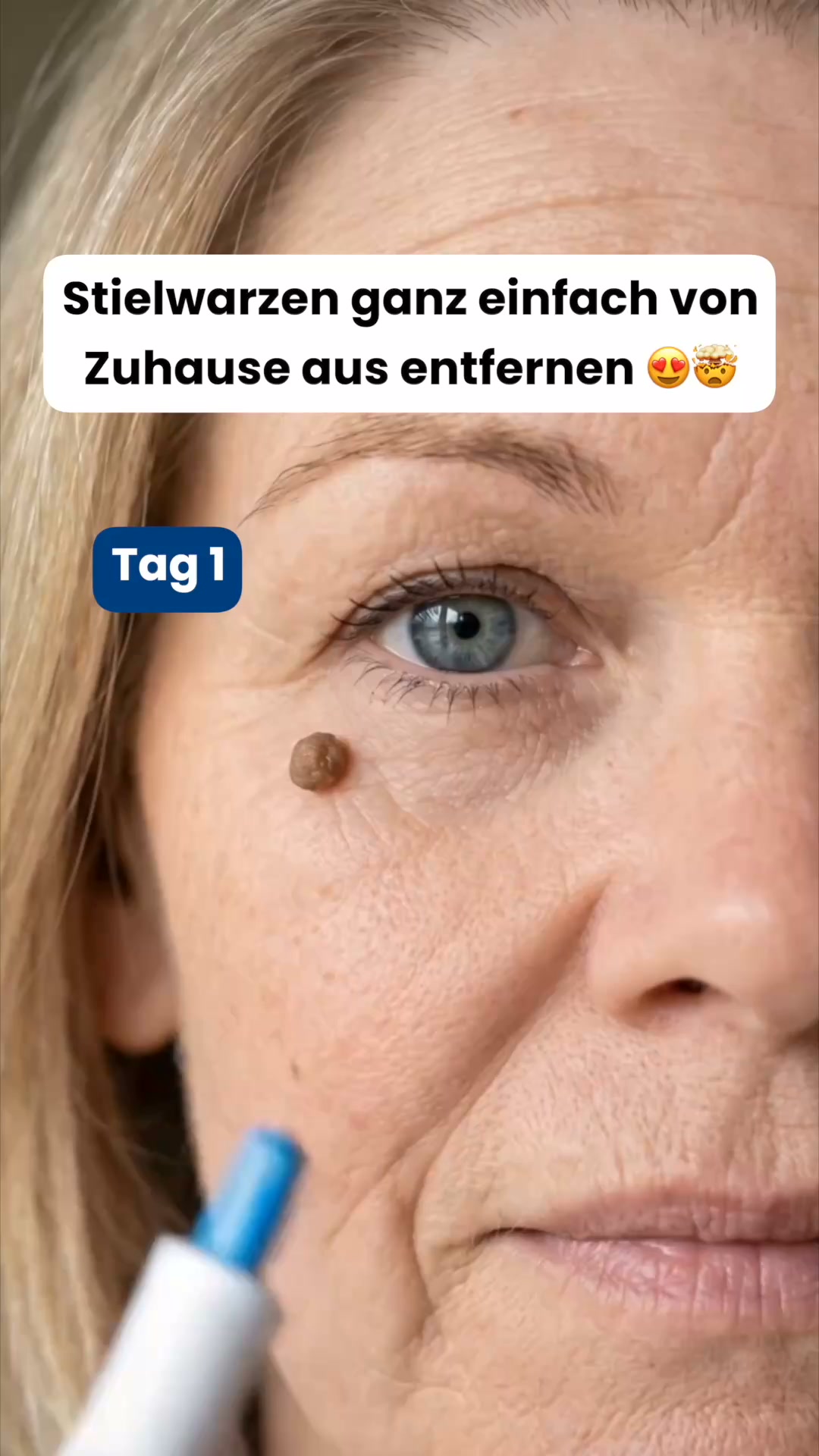 Anúncio de myguy