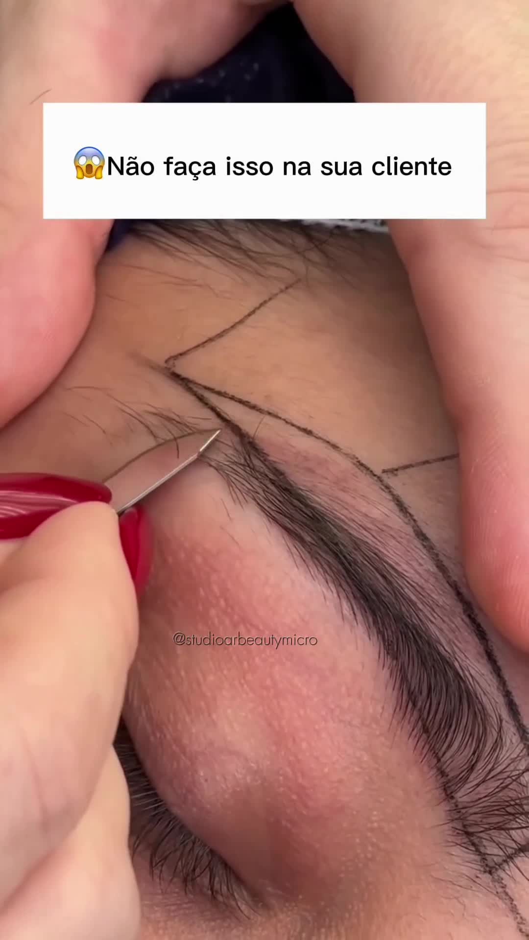 A técnica do fio ultra natural — ao vivo