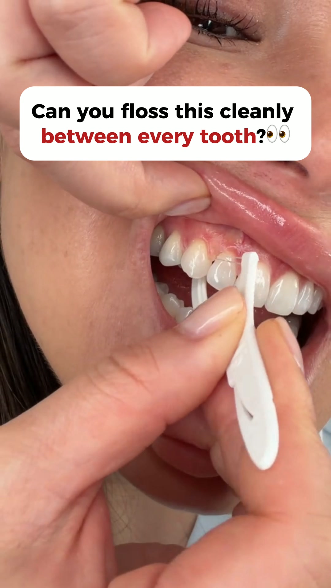 If Floss Gets Stuck, Watch This