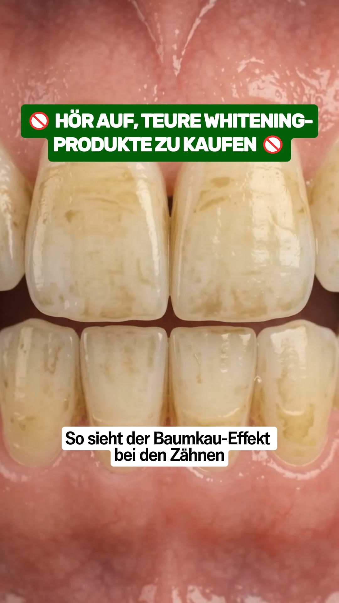 1 Kaugummi, der deine Zähne verändert.