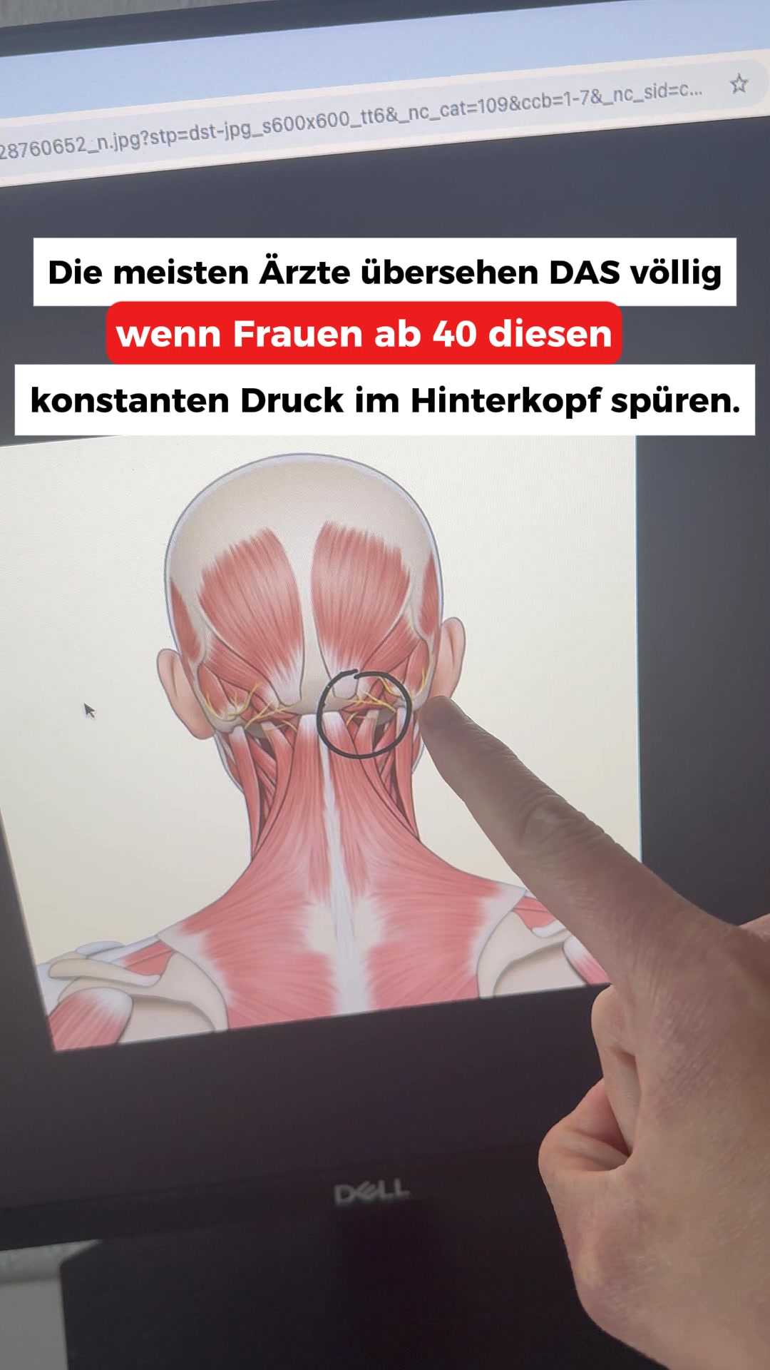 Endlich beschwerdefrei