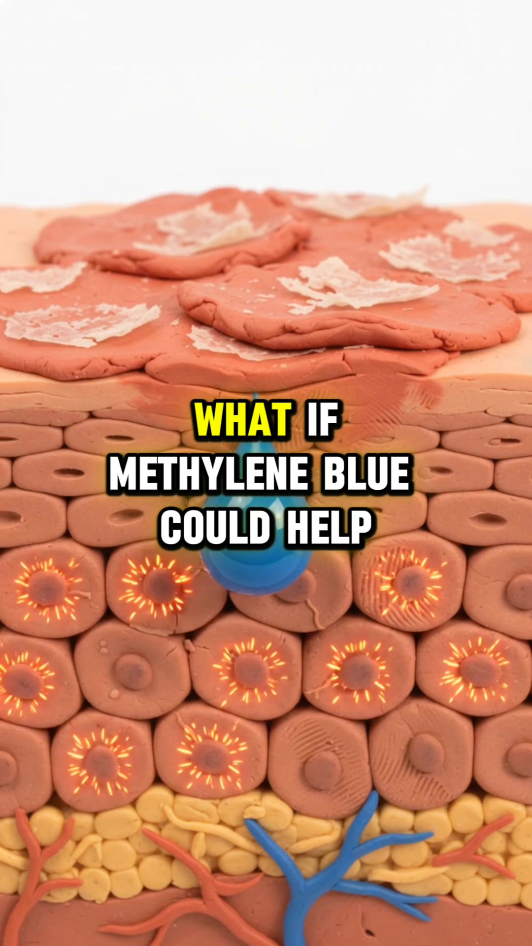 Psoriasis-Prone Skin, Meet Methylene Blue.