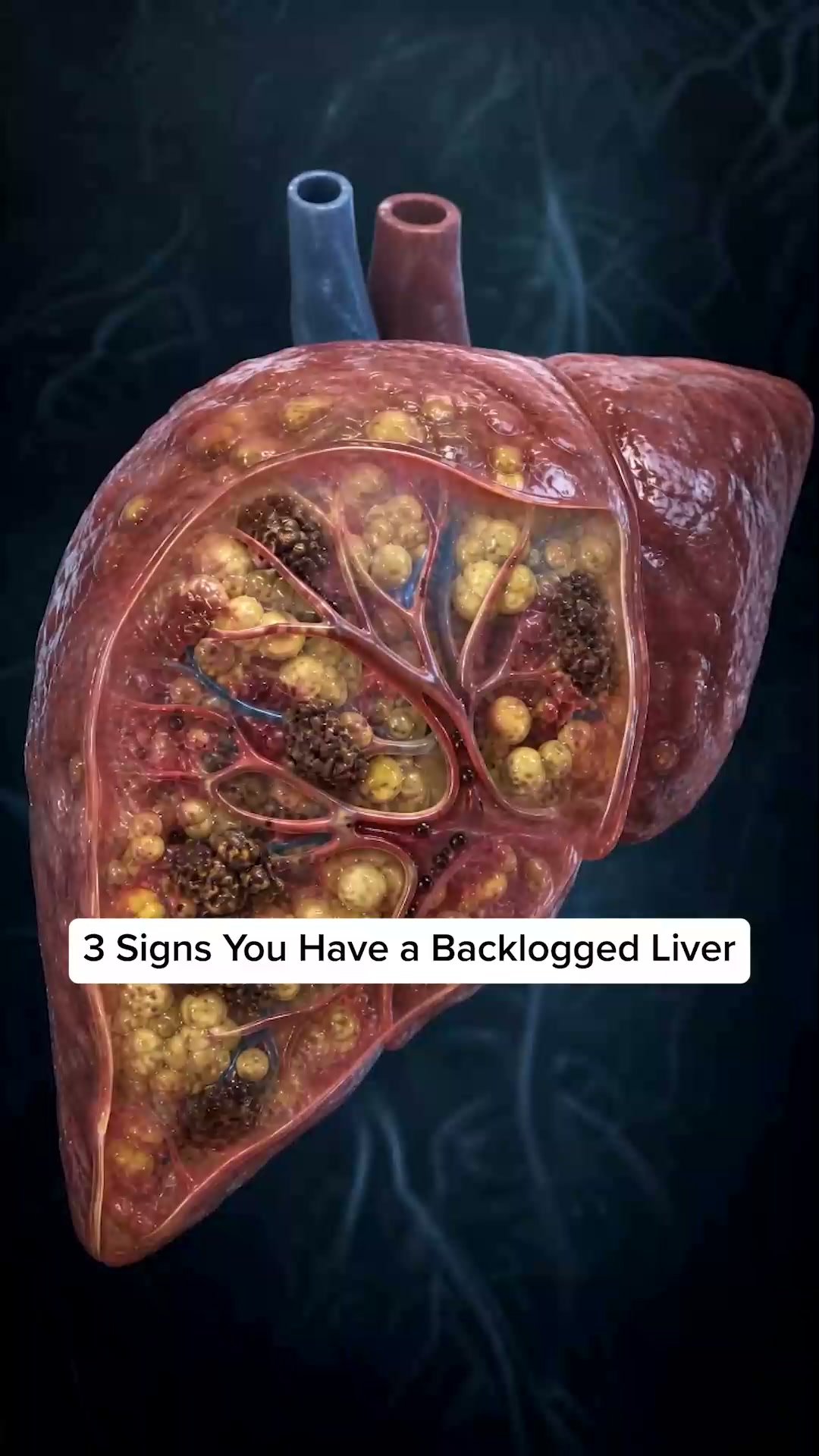 Flush your liver toxins