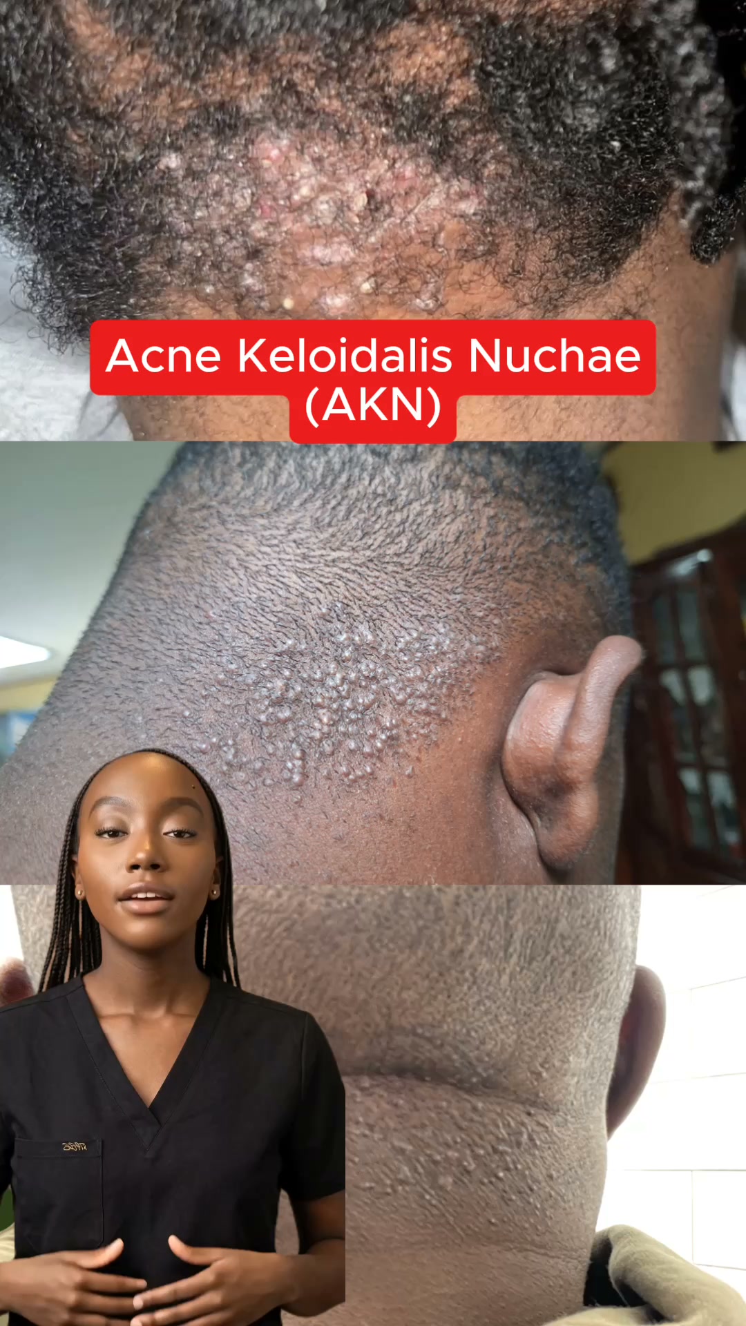 Fix Your AKN. Start Now.