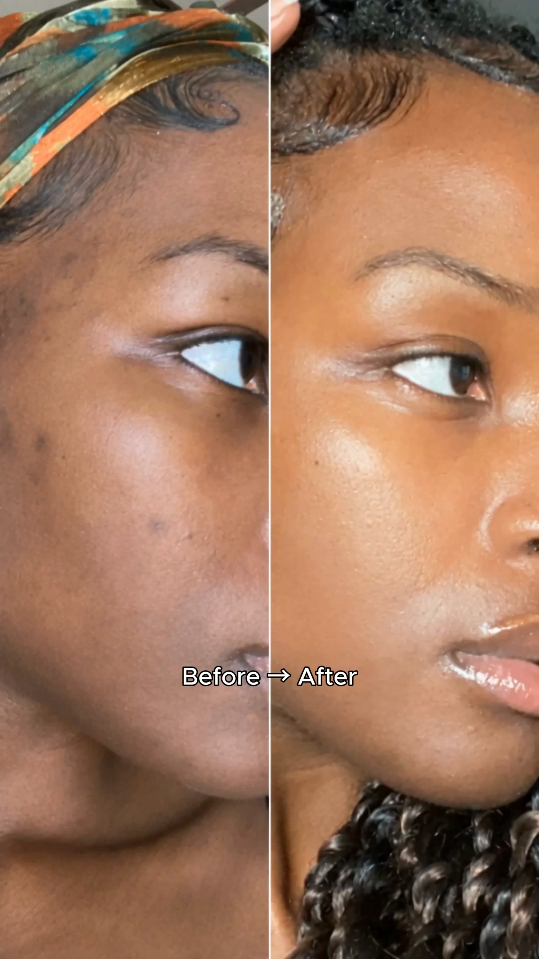 Bright Skin, Simplified