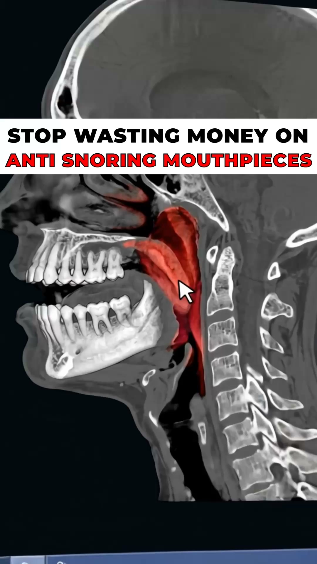 Fix Snoring & Sleepless Nights