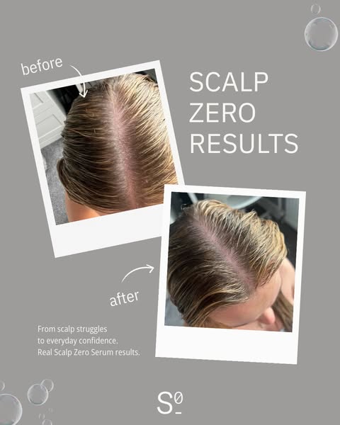 Scalp Serum