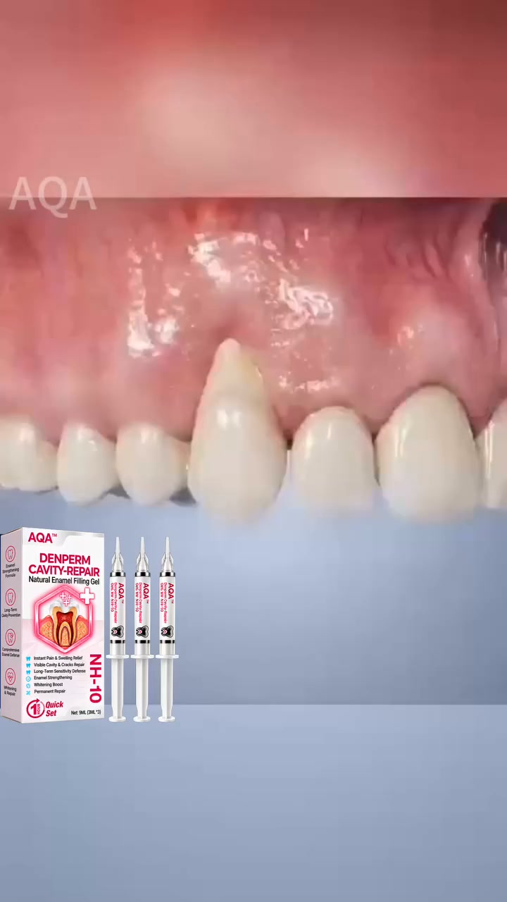 DenPerm Gel harnesses biomimetic 10% Nano-Hydroxyapatite (NH-10) to permanently fill cavities and reconstruct damaged enamel.