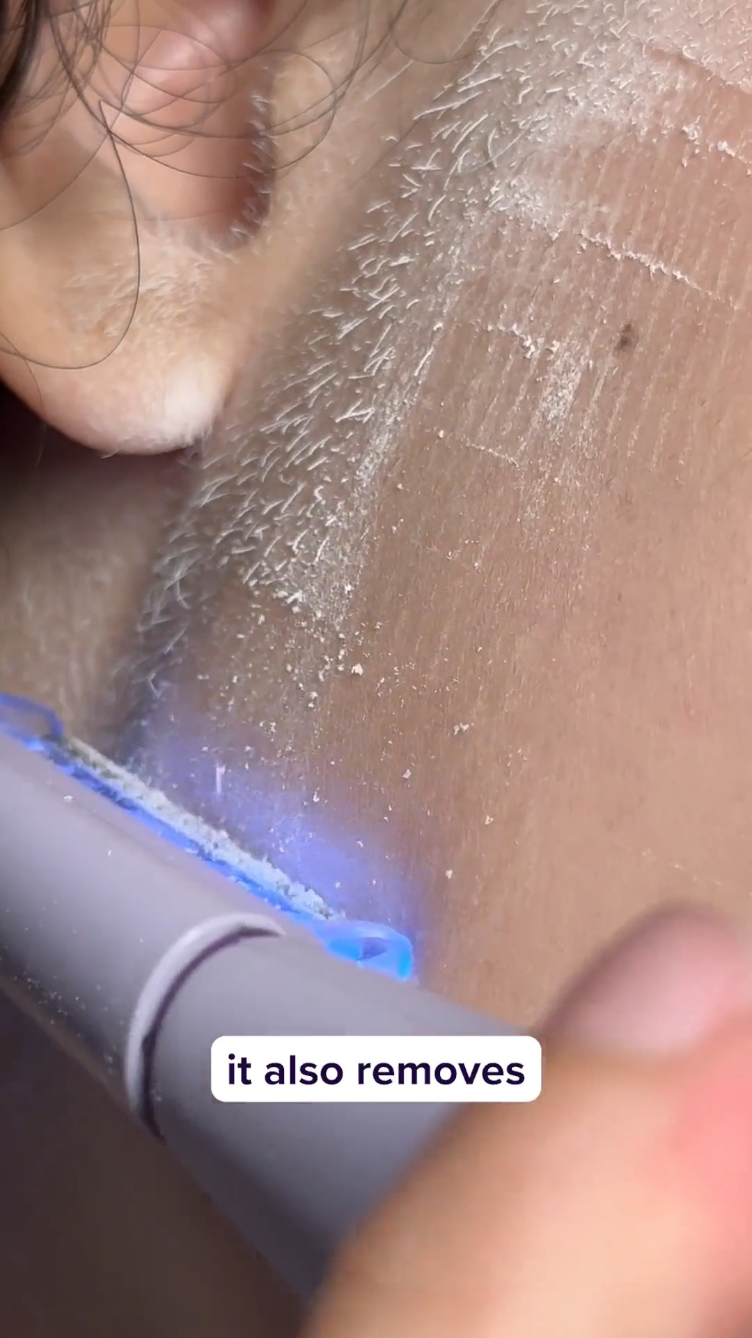 Easy At-Home Dermaplaning
