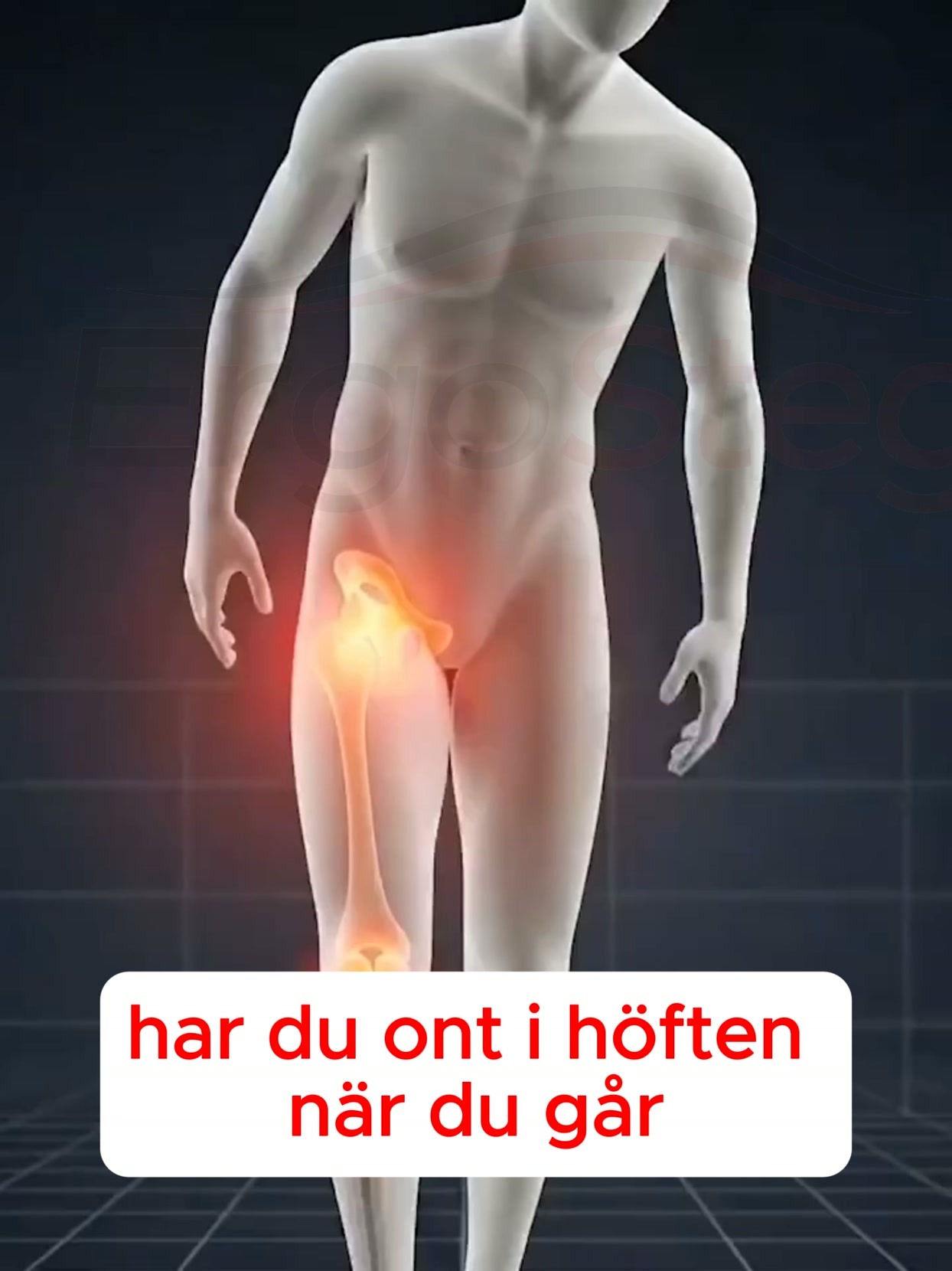 Tänk om höftvärken börjar i foten?