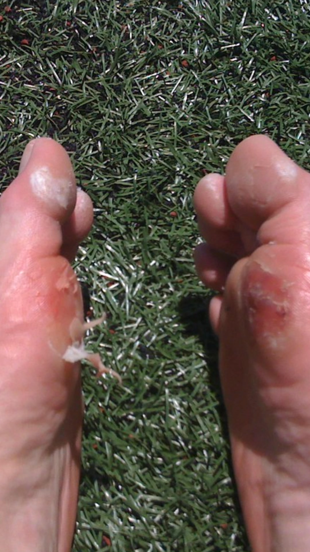 FREE YOUR TOES — 50% OFF TODAY