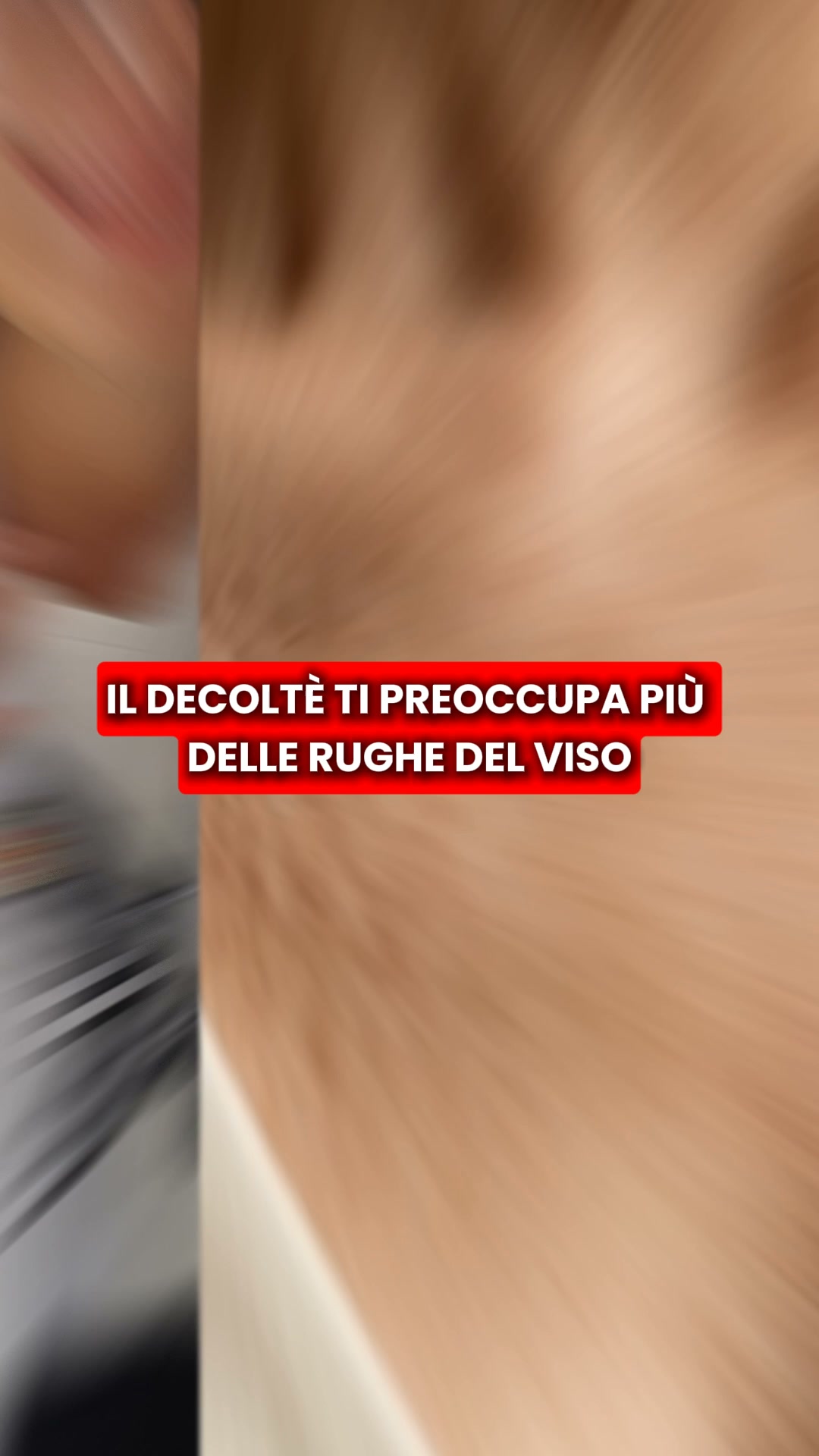 Scopri il kit micro-infusione Renovae