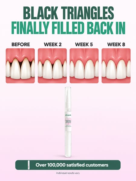 My Gums Kept Pulling Back