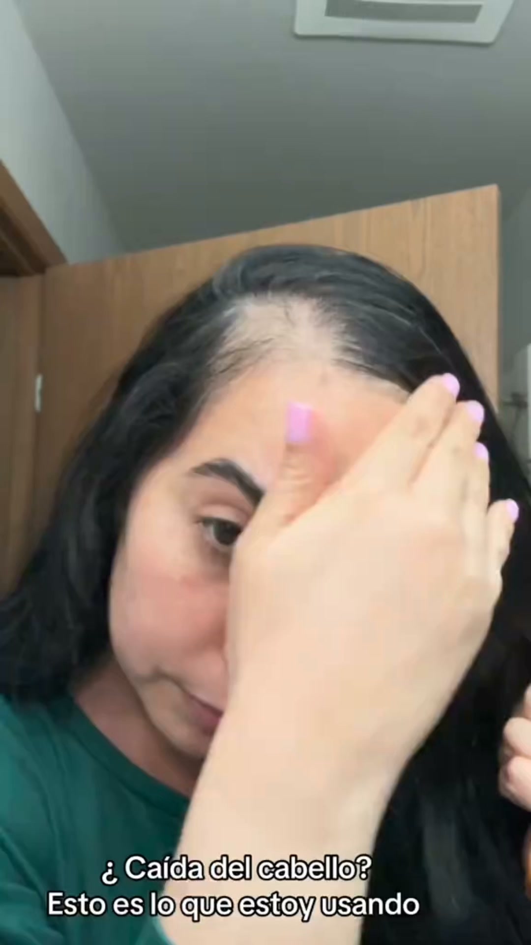 Sin químico, sí raíz