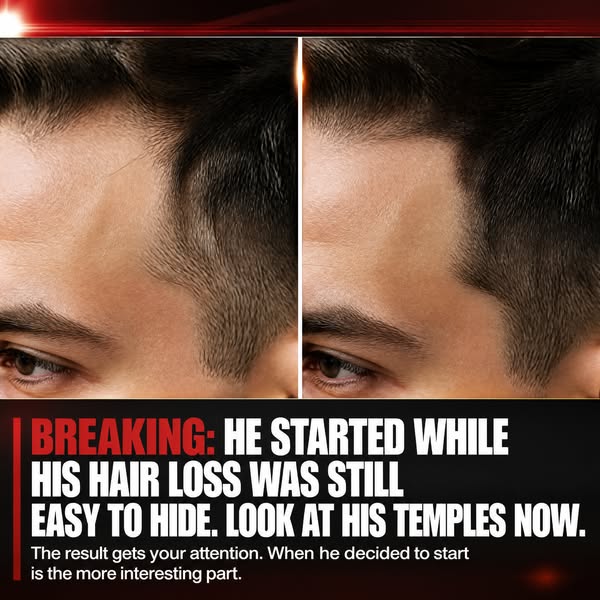 SAVE YOUR HAIR