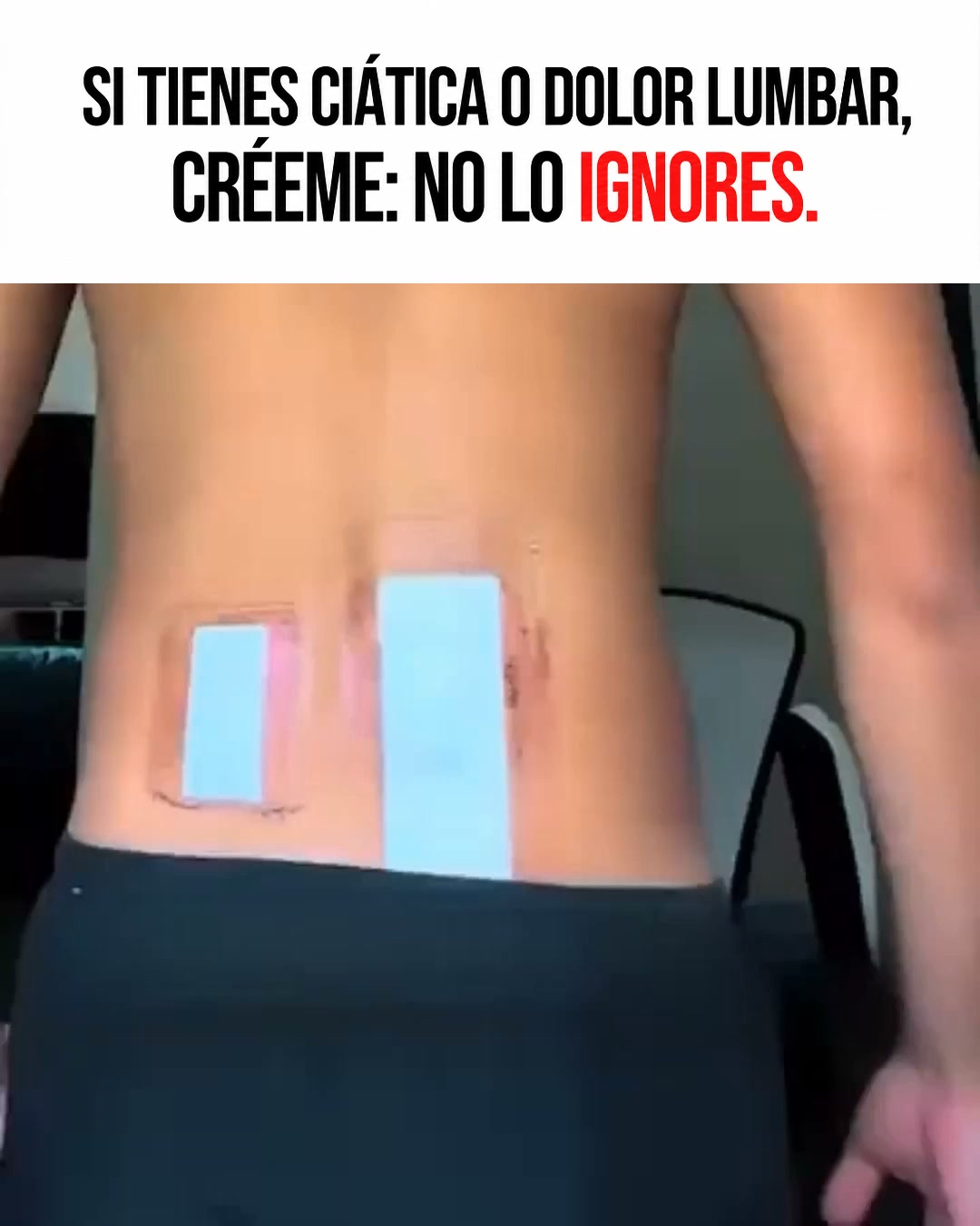 Ignoré mi ciática durante 4 años — fue la peor decisión de mi vida