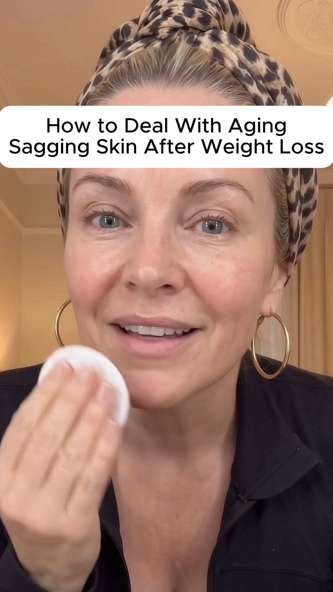 Read this before if you have stretch marks.