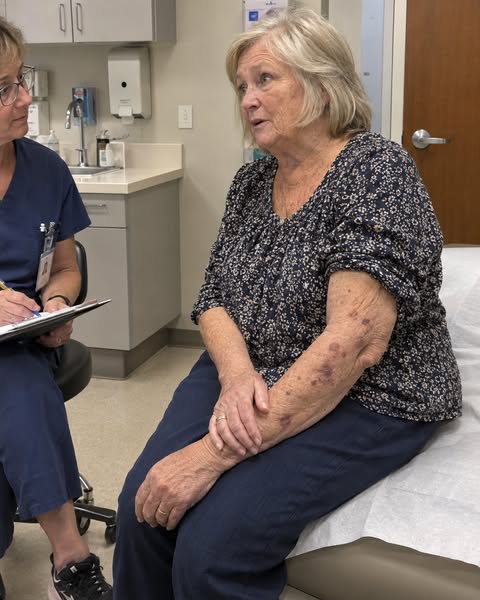 Harmless Does Not Mean “Ordinary Bruise”