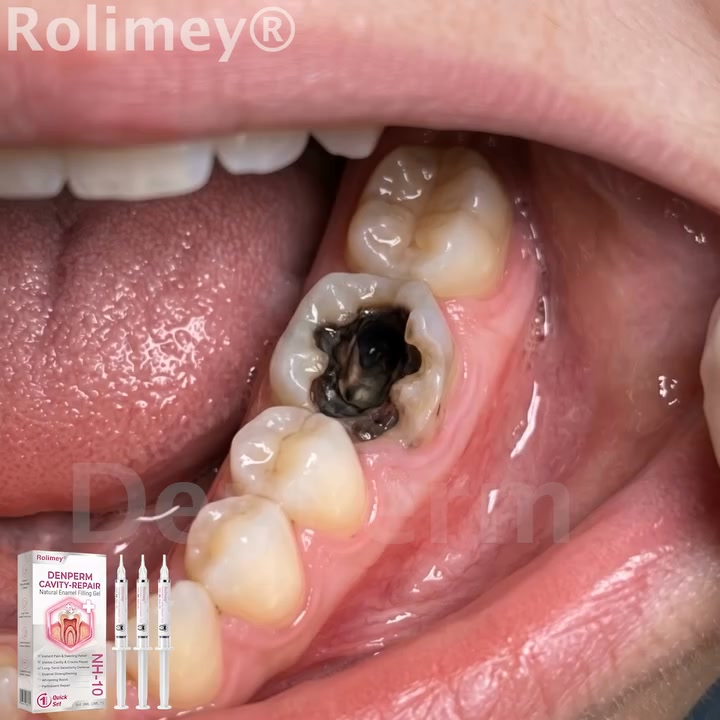 Cavity Repair FDA-Recognized 10% Nano-Hydroxyapatite (NH-10) | Delivery within 2-4 working days | Full refund guarantee