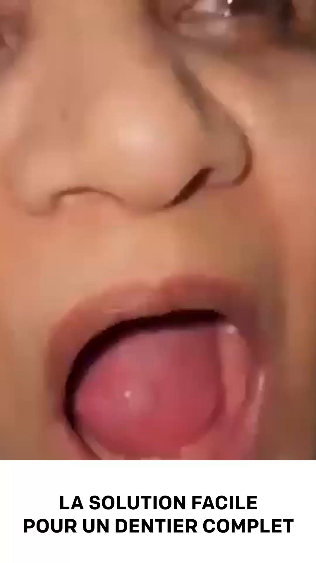 Un sourire naturel instantanément!