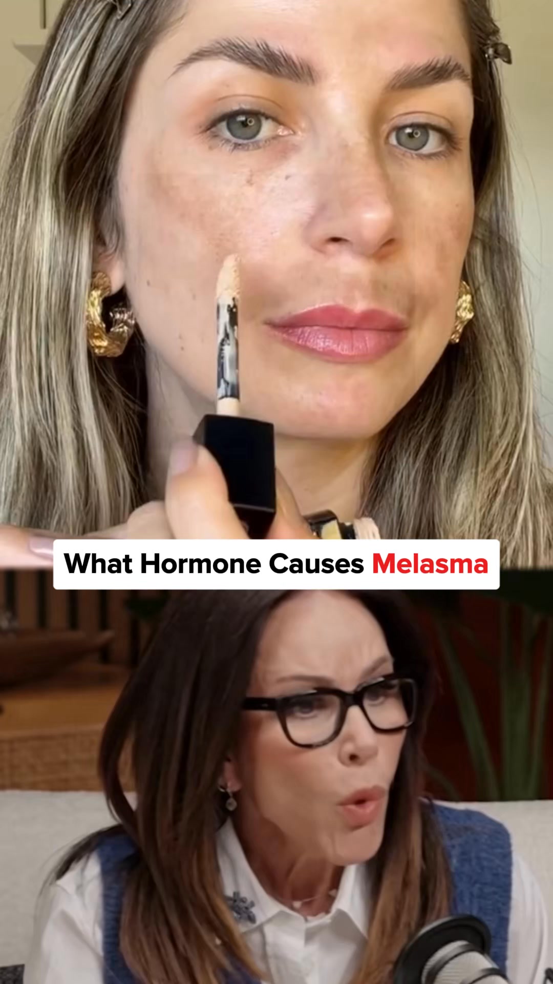 Stop Covering Perimenopause Melasma With Makeup, Do This Instead