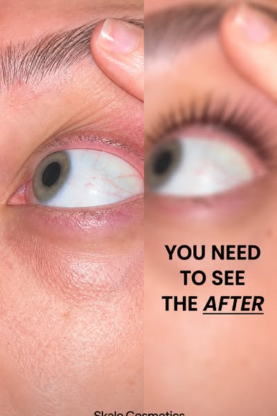 Lash Growth Serum | Clinically Tested & Prostaglandin-Free | Skale Cosmetics