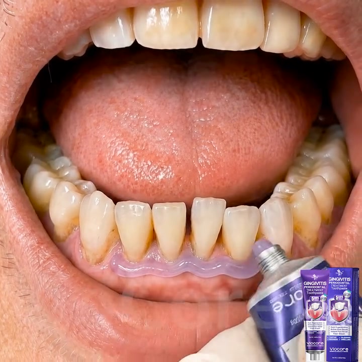 Gum Healing Endorsed by the Academy of Periodontology (AAP) | Delivery within 2-4 working days | Full refund guarantee
