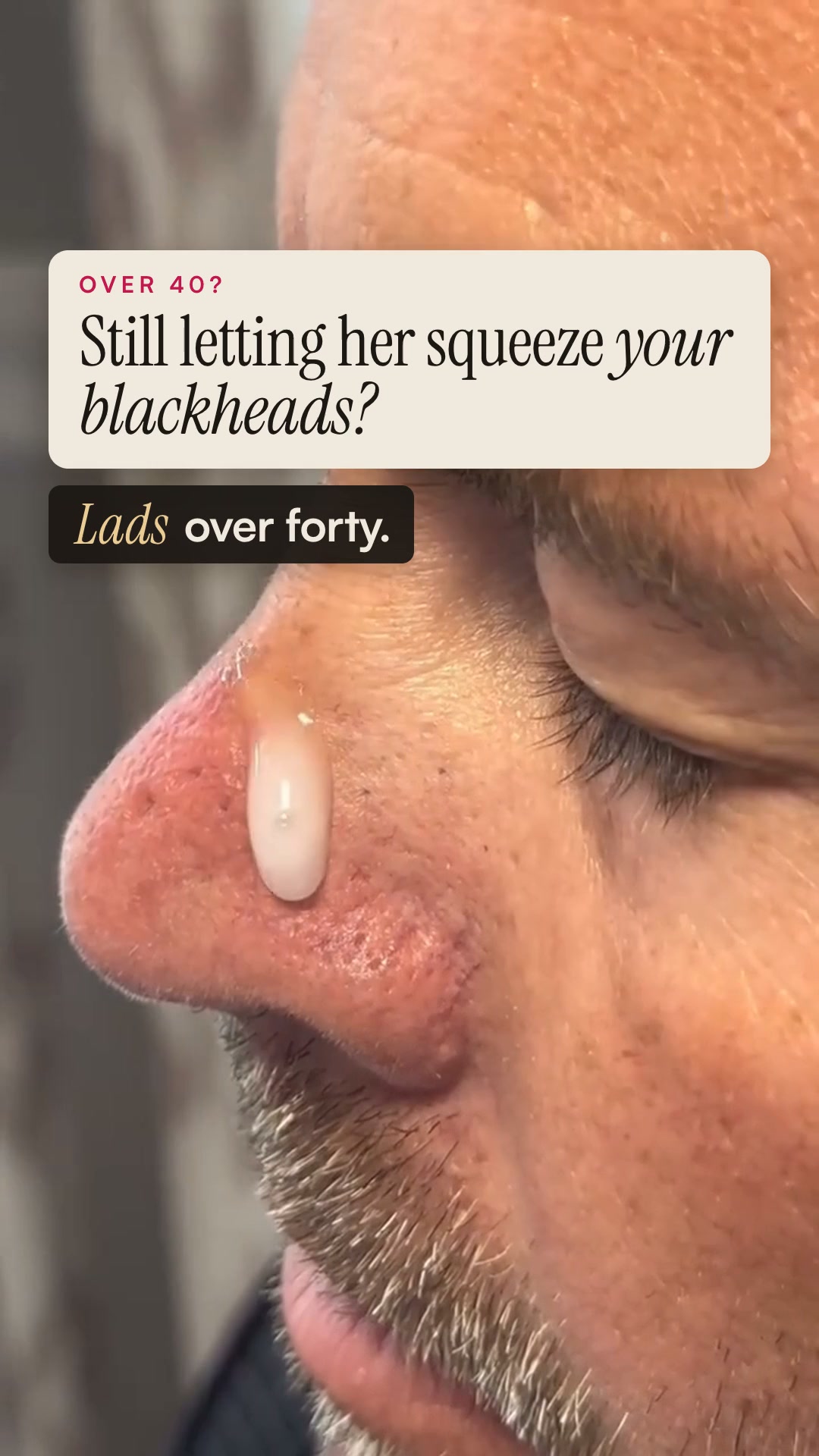 Say goodbye to blackheads