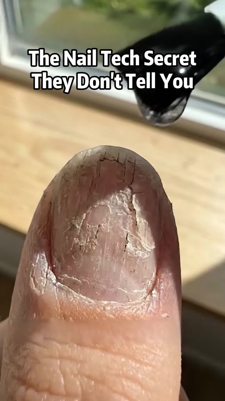 Professional Nail Treatment Bottle