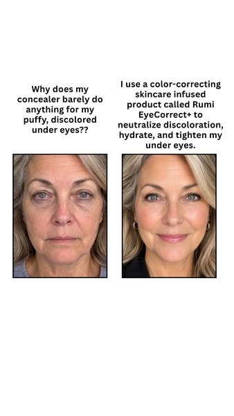 The Under-Eye Fix You've Been Missing