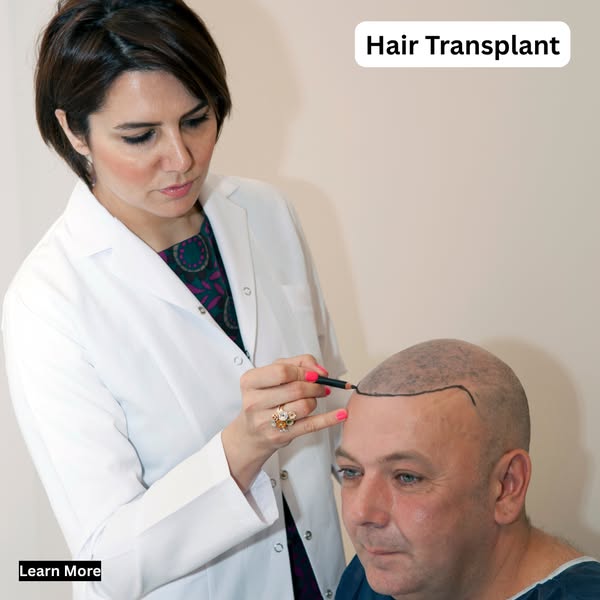 Hair Transplant