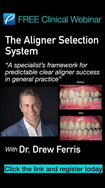 5 Questions to Ask Before Starting Aligners