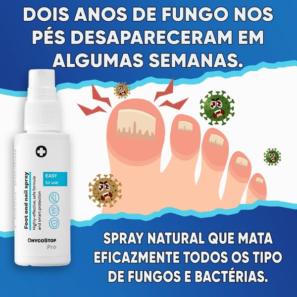Diga adeus aos embaraçantes fungos nas unhas