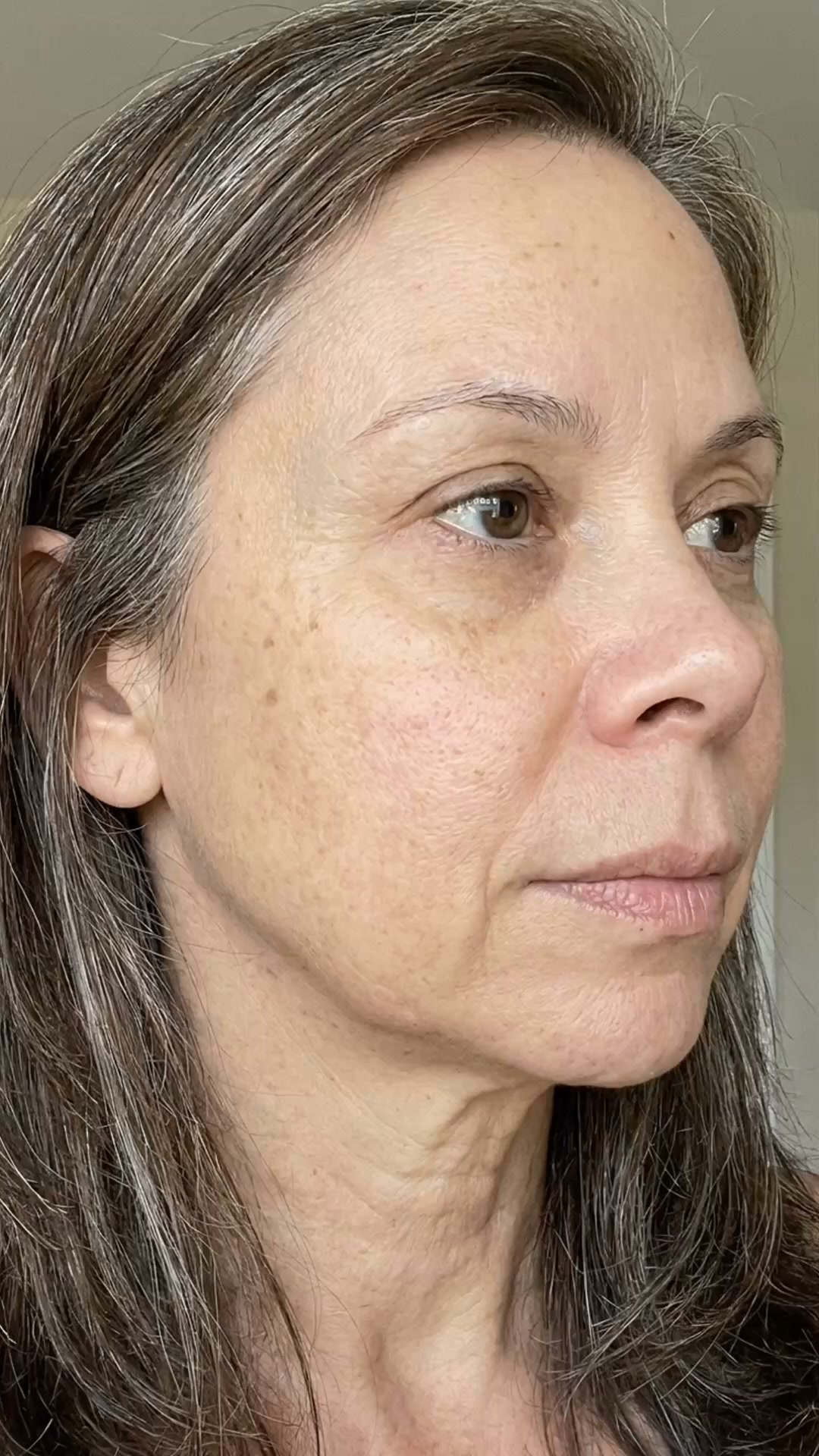 Restore Your Natural Color