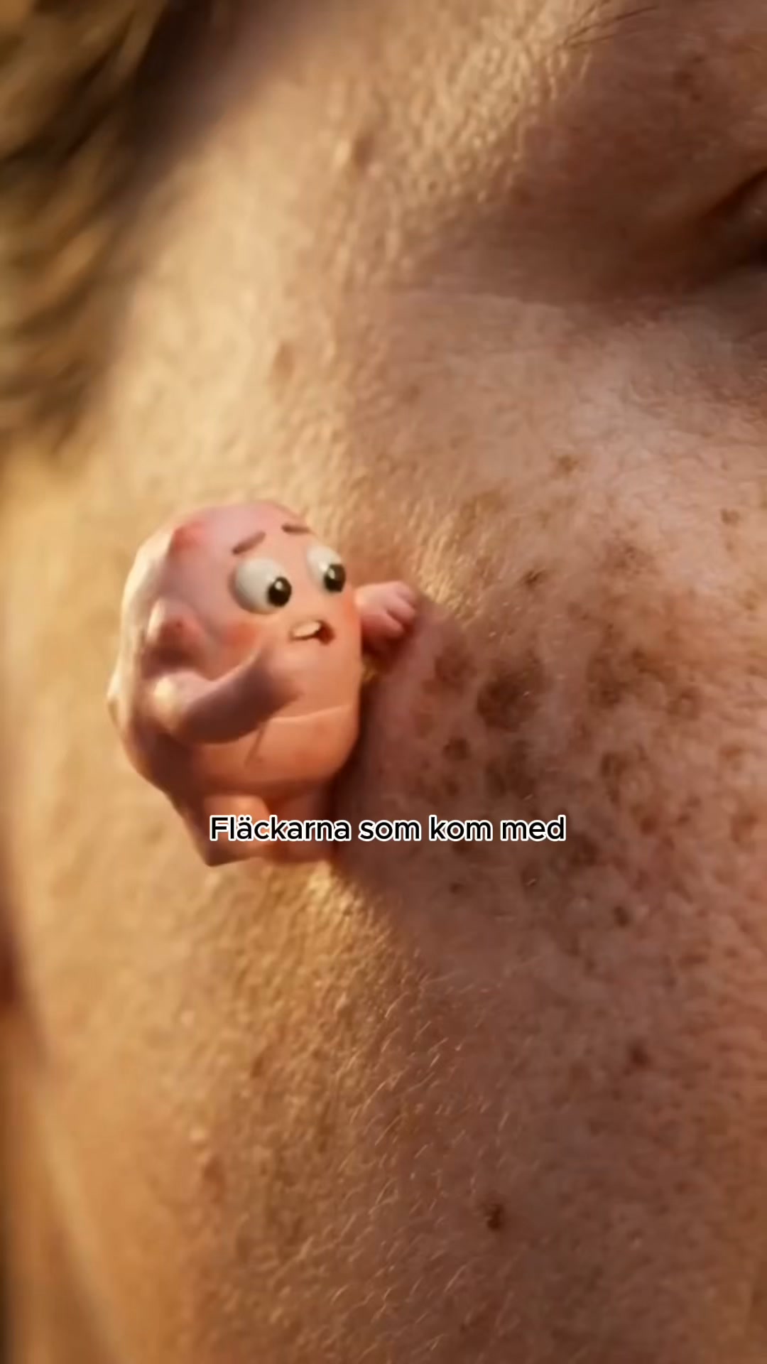 Fläckarna som kom med åren