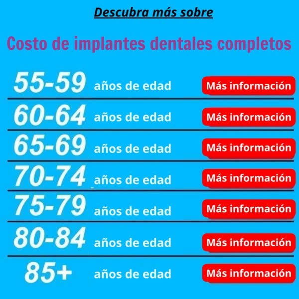 Implantes dentales