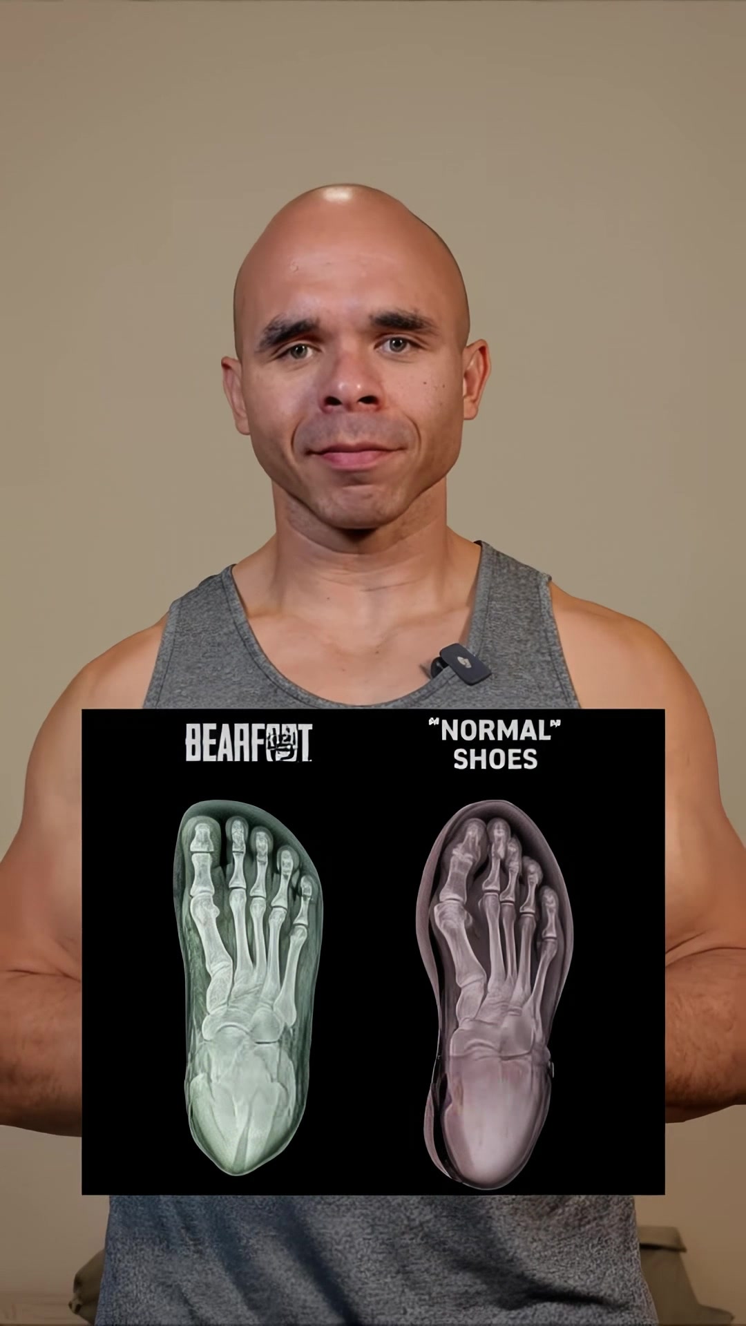 Restore Your Natural Foot Shape