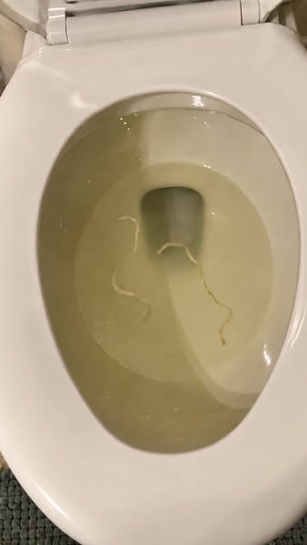 The Gross Photo Made Me Stop. The Symptoms Made Me Read.