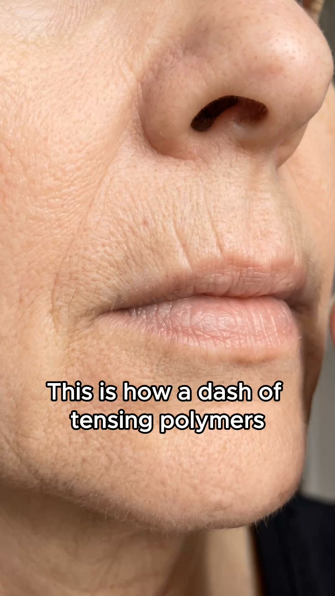 Stop using anti-aging product for lip lines