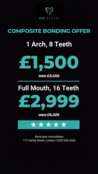Up to 50% Composite Bonding and Veneers